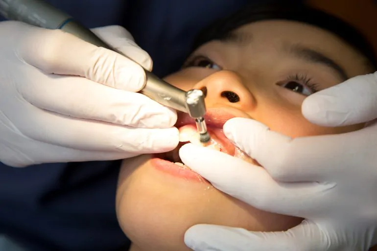 歯周病予防にPMTC