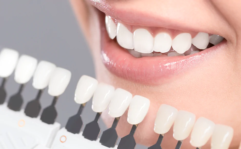 Invisalign AND Ceramic Reconstruction