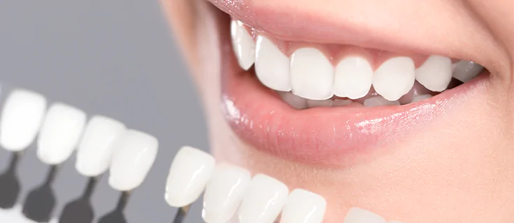 Invisalign AND Ceramic Reconstruction